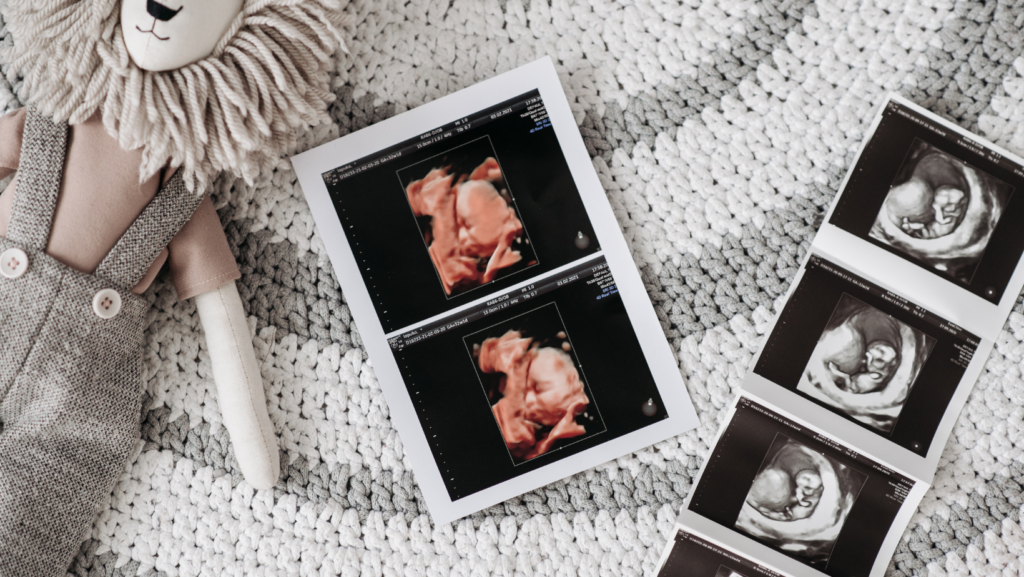 learn how to preare for a baby on a budget - picture of ultrasounds and baby items